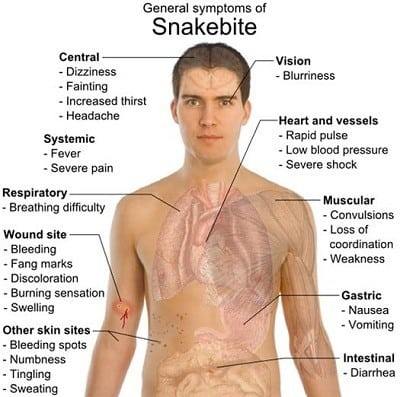 general-symptoms-snake-bite (1)